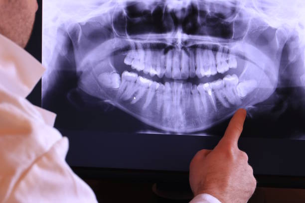 Best Pediatric Emergency Dentist in Surrey, ND