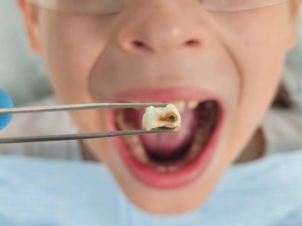 Best Weekend Emergency Dentist in Surrey, ND